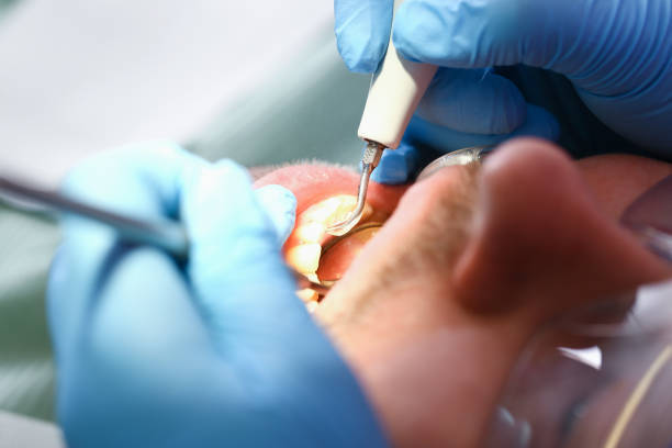 Best After-Hours Emergency Dentist in Kewaskum, WI